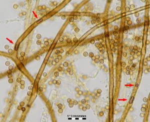 100x_kapilicium07.jpg