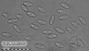 100xCR-Spores.jpg