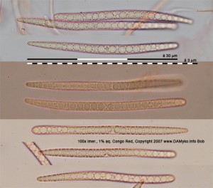 100xCRMR-Spores-3.jpg