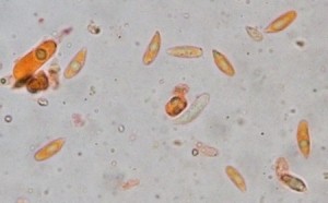 100xim_CR_Spores02.jpg