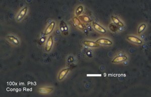 100ximPh_CR_Spores01_10krat3.jpg