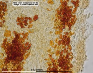 100xMR-ACells-1.jpg