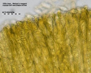 100xMR-Hymenium.jpg
