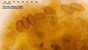 100xMR-Spores-02.jpg