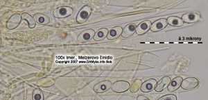 100xMR-Spores1.jpg