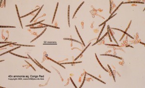 40x_CR_Spores_01.jpg