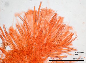 40x_Hymenofor_CongoRed_2.jpg