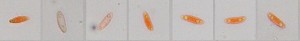 40x_Spores_CongoRed_3.jpg