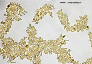 40x_Spores_Melzer_2.jpg
