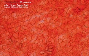 40xCR-Excipulum-01.jpg