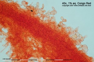 40xCR-Excipulum.jpg