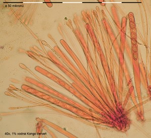 40xCR-Hymenium-1.jpg