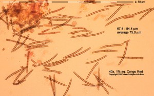 40xCR-Spores-6.jpg