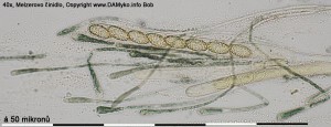 40xMR-Hymenium-1.jpg