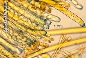 Asi_peziza_succosella-Hymenium-MR-02.jpg