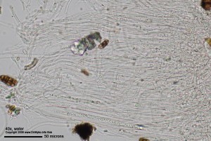 CucurbitariaLaburni13.jpg