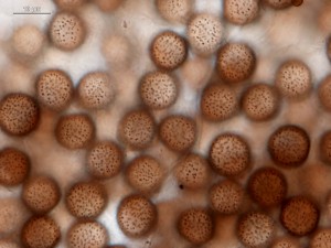 Diacheopsis vermicularis--11.jpg