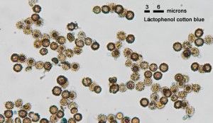 HB-Spores100xCB.jpg