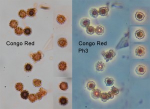HB-Spores100xCR-Ph3.jpg