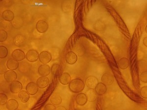 hemitrichia--11b.jpg