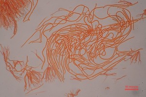 KropilkaDubovyKopec1-DlouheHyfy01.jpg