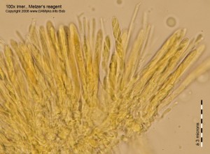 Lachnellula-Smrk-Mikro01.jpg