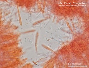 Lachnellula-Smrk-Mikro02.jpg