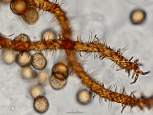 metatrichia--11b.jpg