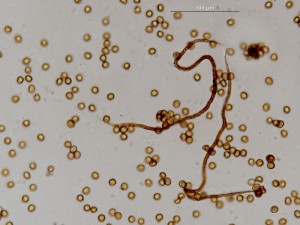metatrichia--27.jpg