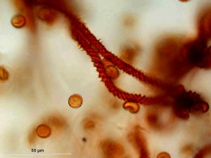 myxomycet11.jpg
