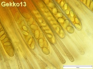 Pachyella babingtonii mikro2.jpg