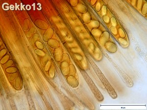 pachyella_babingtonii_mikro2_774a.jpg