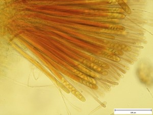Pachyella babingtonii mikro.jpg