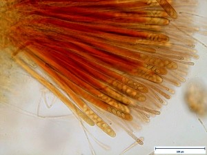 pachyella_babingtonii_mikro_182a.jpg
