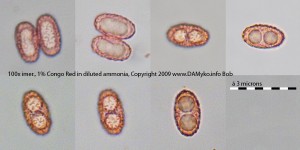 PezizaMichelii-04-VP-100xCR.jpg