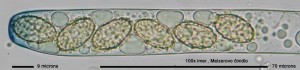 Rasnatka100xMR-Vrecko-02.jpg