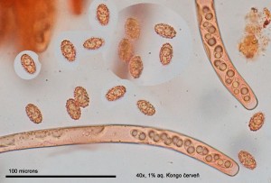 Rasnatka10xCR-Vytrusy-01.jpg