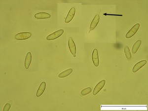 Rustroemia bolaris Spory.jpg