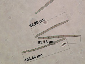 trichoglossum walteri spores1a.jpg