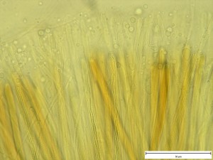 Vibrissea decolorans mikro1.jpg
